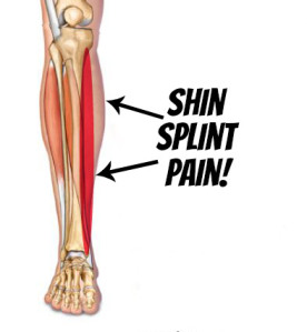 Medial Tibial Stress Syndrome: Shin Splints! - RunWaterloo