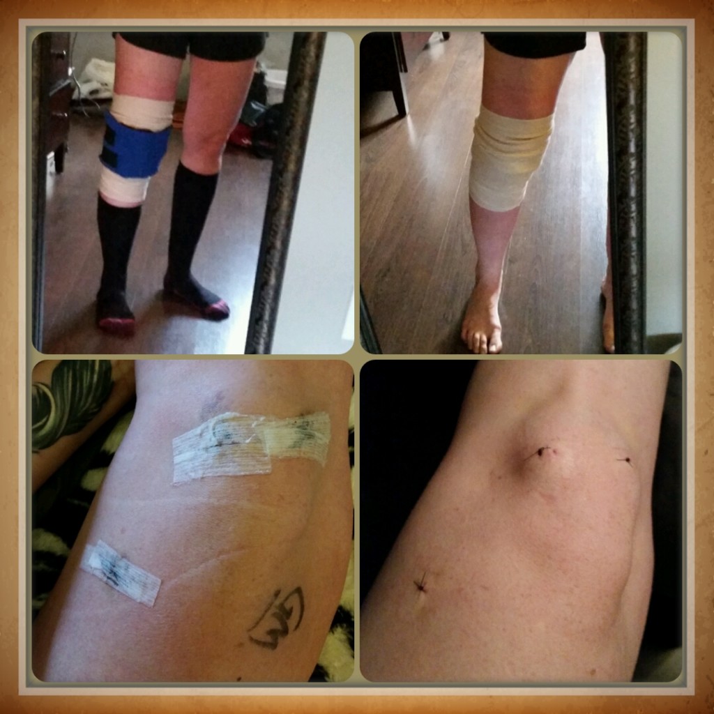 kristy-goss-knee-surgery